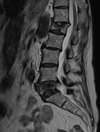 MR_MRI LUMBAR SPINE WITHOUT CONTRAST_SAG T2_2023-08-16.png