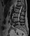 MR_MRI LUMBAR SPINE WITHOUT CONTRAST_SAG T2_2023-08-16 (1).png